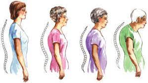 OSTEOPOROZ VE AĞIZ SAĞLIĞI